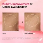 Anua Niacinamide 5 + Txa Brightening Pad view 6
