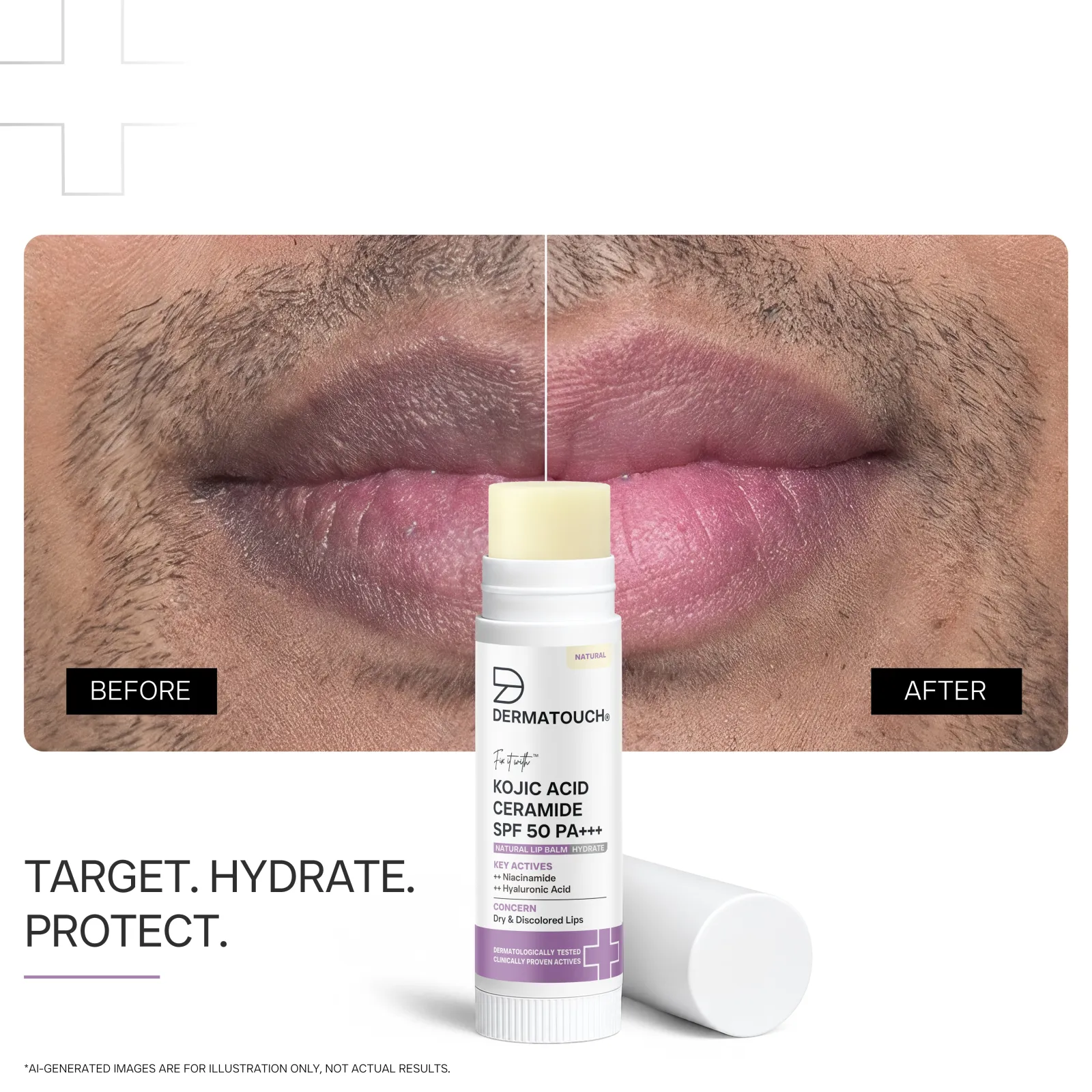 Dermatouch Kojic Acid Ceramide SPF 50 PA+++ Natural Lip Balm for Dry & Discolored Lips 5g