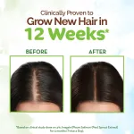 Mamaearth Rosemary Hair Growth Scalp Serum view 2