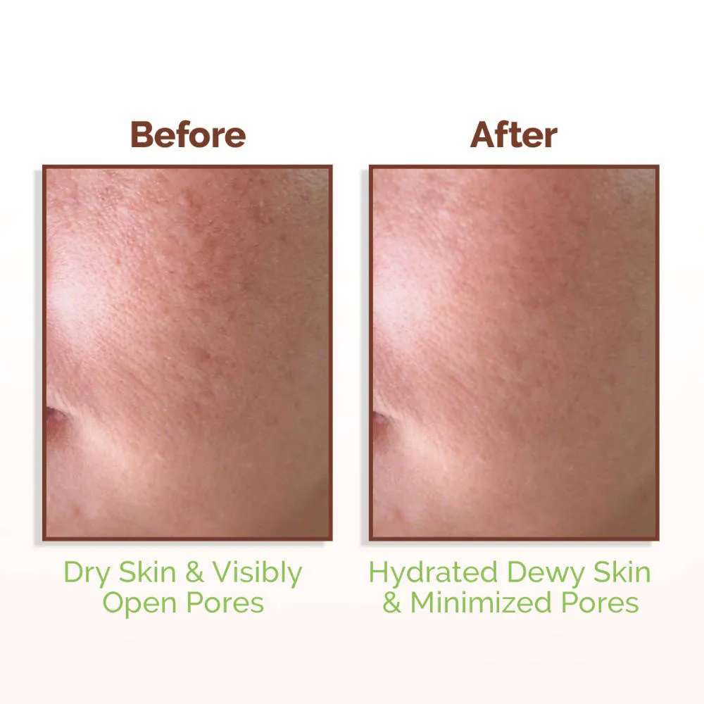 Mamaearth Rice Water Dewy Face Toner with 4% Niacinamide for Glass Skin and All Skin Types