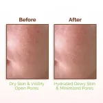 Mamaearth Rice Water Dewy Face Toner with 4% Niacinamide for Glass Skin and All Skin Types view 6