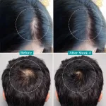 Pilgrim 3% Redensyl 4% Anagain Rosemary Advance Hair Growth Serum For Men & Women- Pack of 2 view 8