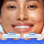 Aqualogica Bright+ Hydra Gel Moisturizer view 8