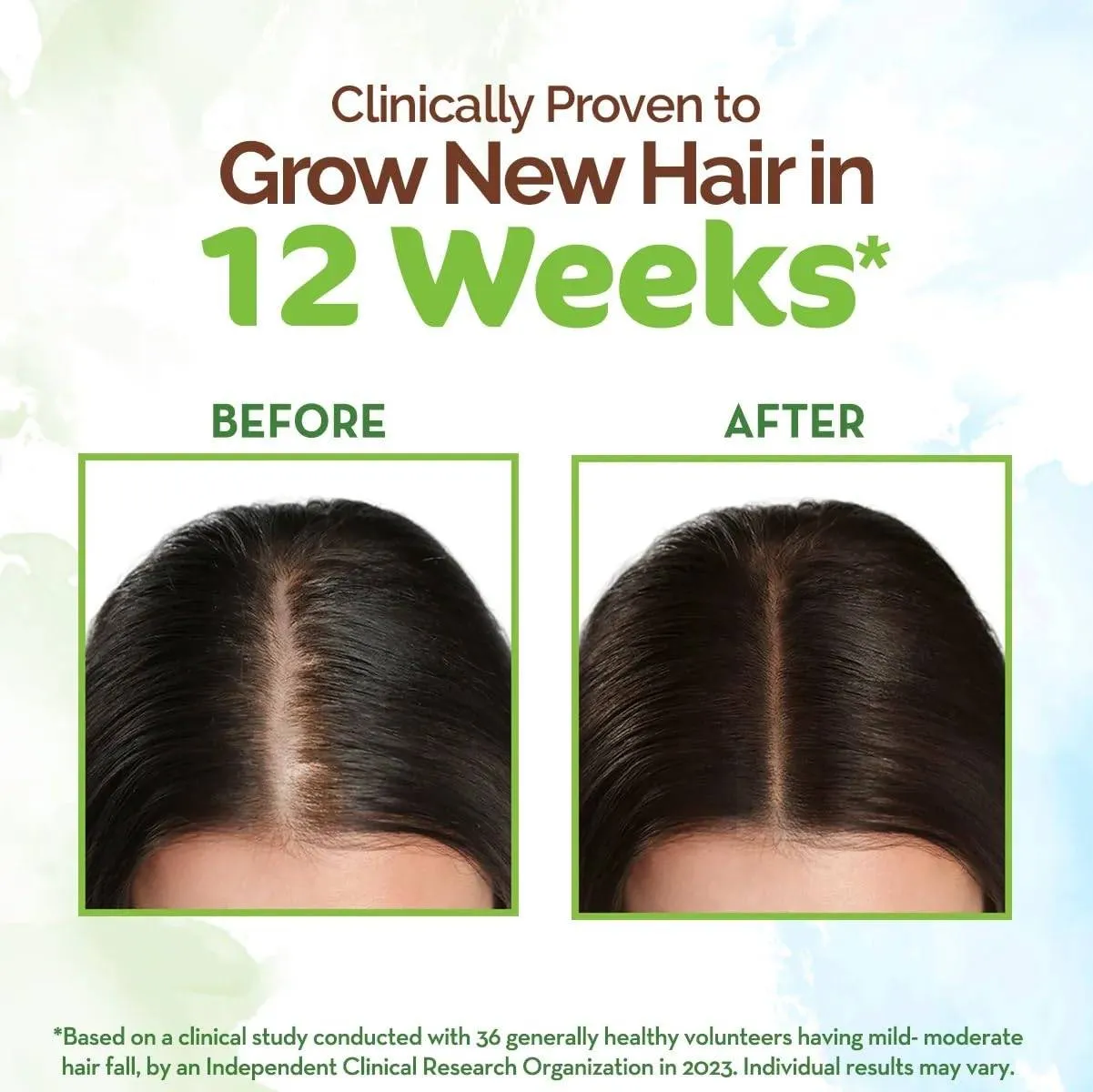 Mamaearth Rosemary Hair Care Combo for Stronger Hair Reduces Hair Fall, Boosts Growth & Shine