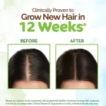 Mamaearth Rosemary Hair Care Combo for Stronger Hair Reduces Hair Fall, Boosts Growth & Shine view 11