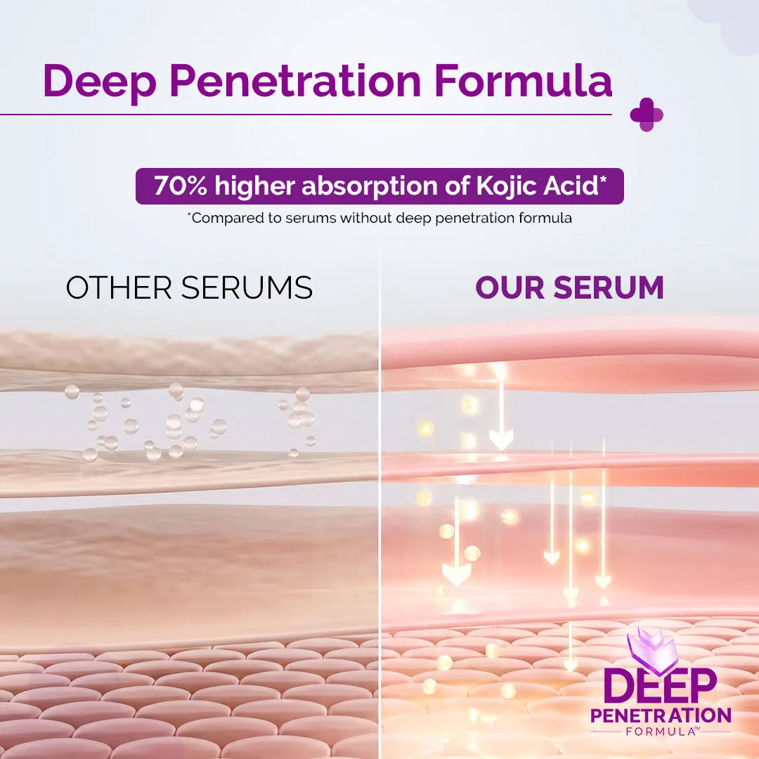 The Derma Co 2% Kojic Acid Face Serum for Dark spots reduction, Pigmentation & Blemishes