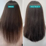 Pilgrim Redensyl & Anagain Hairfall Control Shampoo With Growth Boosters For Thick & Dense Hair view 13