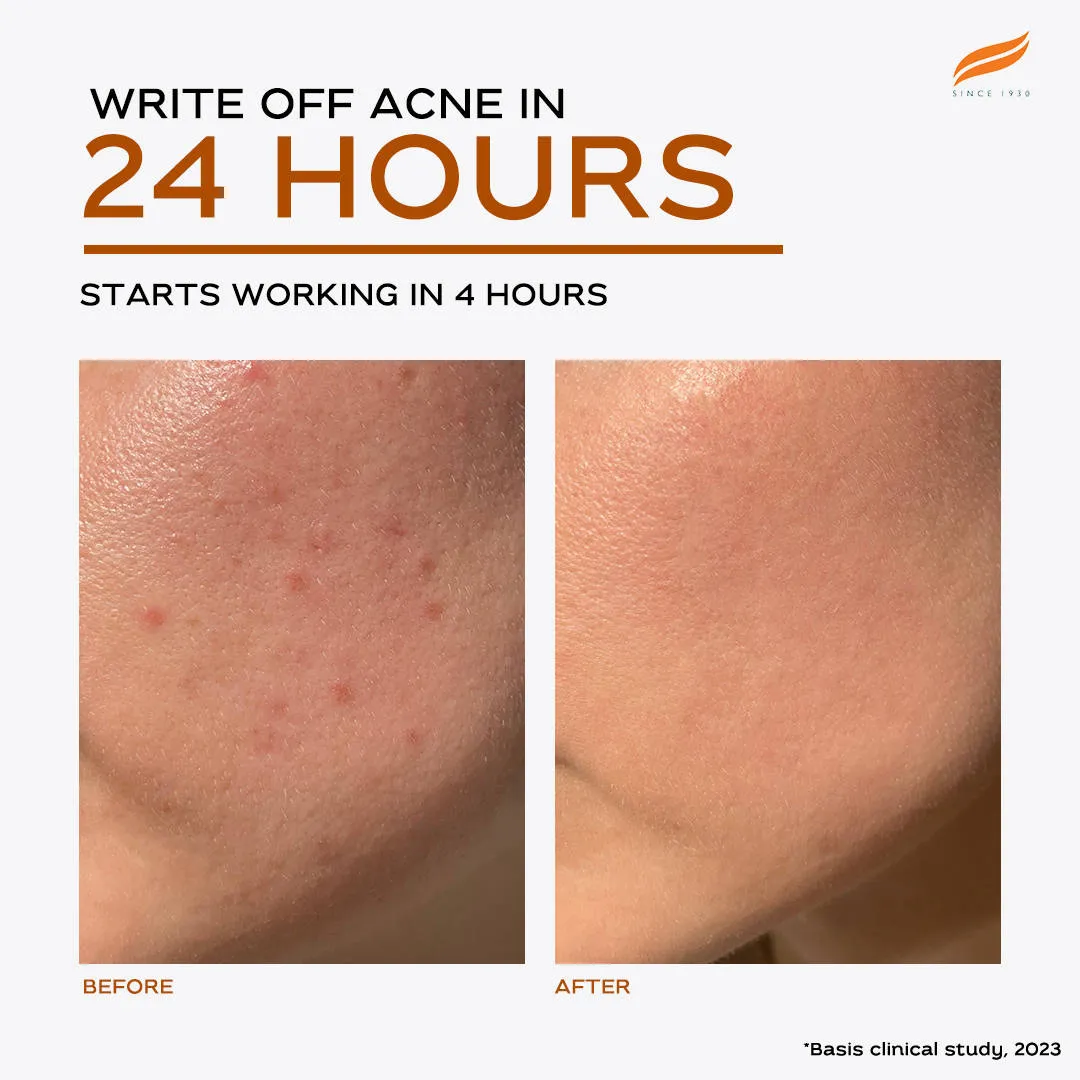 Himalaya Acne Clear+ Spot Treatment Pen with 2% Natural Salicylic Acid Reducing Acne Size in 24 hrs