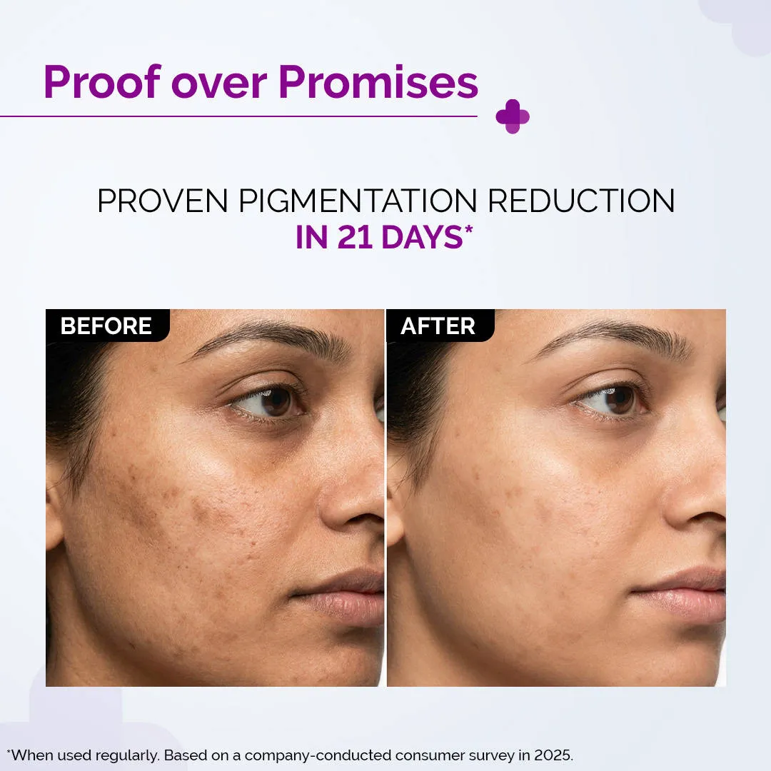 The Derma Co 2% Kojic Acid Face Serum for Dark spots reduction, Pigmentation & Blemishes