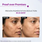 The Derma Co 2% Kojic Acid Face Serum for Dark spots reduction, Pigmentation & Blemishes view 8