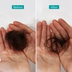 Pilgrim Redensyl & Anagain Hairfall Control Shampoo view 5