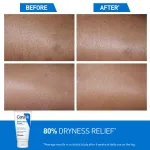 CeraVe Moisturizer Cream For Dry Skin With Ceramides & Hyaluronic Acid For Barrier Repair view 5