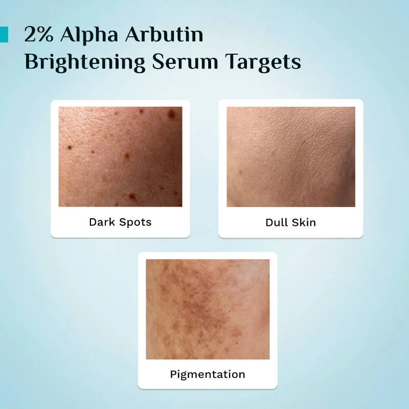 Pilgrim 2% Alpha Arbutin & 3% Vitamin C Brightening Serum, Fades Pigmentation & Brightens Skin