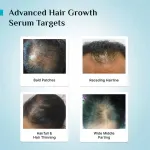 Pilgrim 3% Redensyl 4% Anagain Rosemary Advance Hair Growth Serum For Men & Women- Pack of 2 view 9