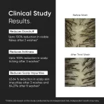 Minimalist Anti-Dandruff Shampoo 3.5% Salicylic Acid For Flaky & Itchy Scalp, Gentle & Sulphate-Free view 3
