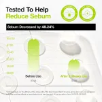 Anua Ultra-Thin Spot Cover Patch Invisible Hydrocolloid Acne Patches, Soothes & Reduces Breakouts view 5