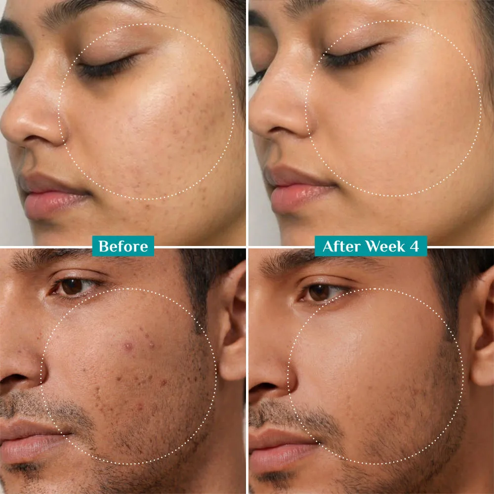 Pilgrim 10% Niacinamide with Kojic Acid & Korean Rice Water Face Serum For Clear Glass Skin Glow