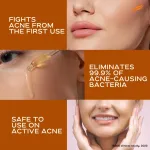 Himalaya Acne Clear+ Scar Removal Serum with 2% Natural Salicylic Acid Reducing Acne & Pigmentation view 7