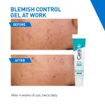 CeraVe Blemish Control Gel with 2% Salicylic Acid, AHA & Niacinamide for Acne Spot Treatment view 4