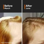 Minimalist Hair Growth Actives 18% Hair Serum view 7