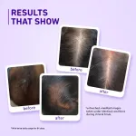 Plum Rosemary & 3% Redensyl Hair Growth Serum view 5