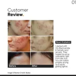 Minimalist 2% Salicylic Acid Face Serum For Blackheads & Whiteheads view 7