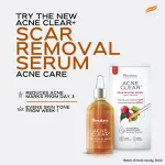 Himalaya Acne Clear+ Scar Removal Serum with 2% Natural Salicylic Acid Reducing Acne & Pigmentation view 9