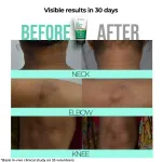 Dr. Sheth's Kesar & Kojic Acid Neck, Knee & Elbow Cream view 3