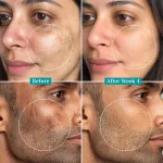 Pilgrim 15% Vitamin C Serum for Advance Brightening Fades Hyperpigmentation & Dark Spots Anti Aging view 8