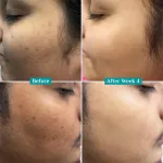 Pilgrim 10% Niacinamide with Kojic Acid & Korean Rice Water Face Serum For Clear Glass Skin Glow view 16