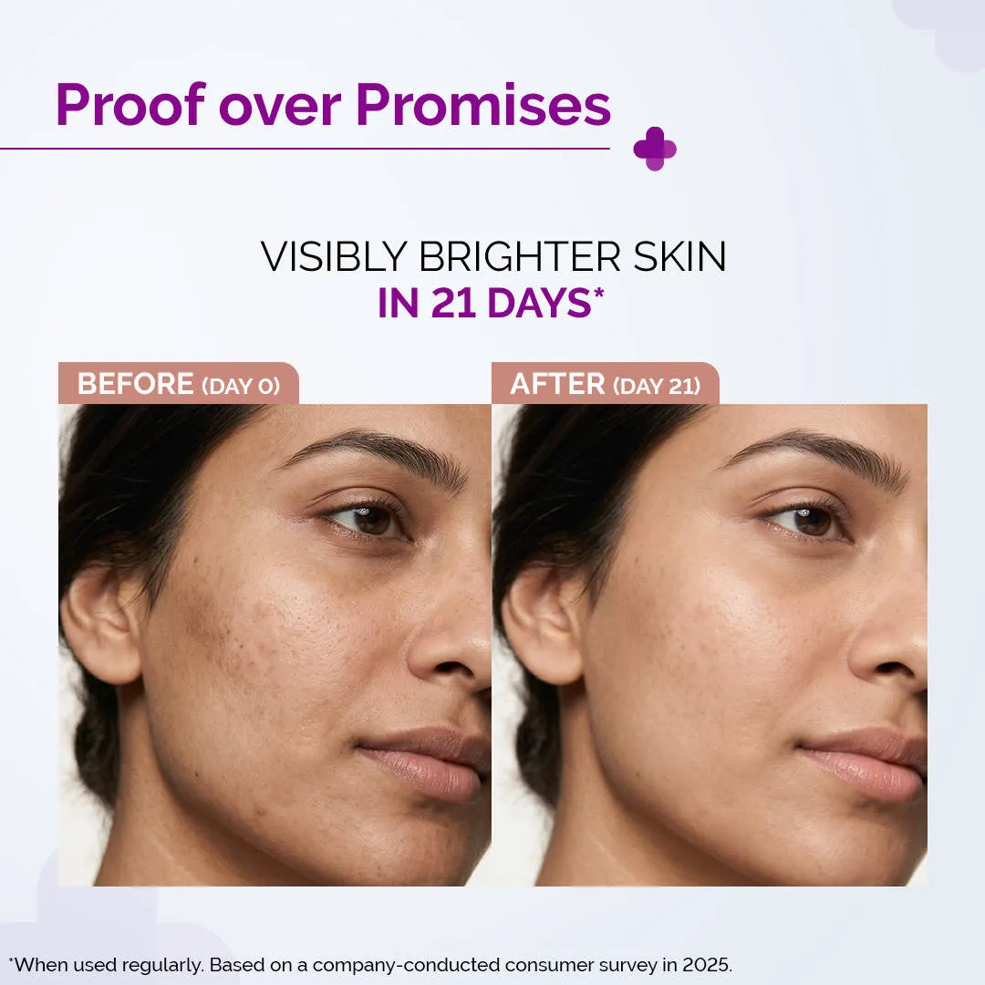 The Derma Co 10% Vitamin C Face Serum Reduces Pigmentation & Glowing Skin For All Skin Types