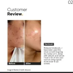 Minimalist 2% Salicylic Acid Face Serum For Blackheads & Whiteheads view 8