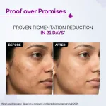 The Derma Co 2% Kojic Acid Face Serum for Dark spots reduction, Pigmentation & Blemishes view 6