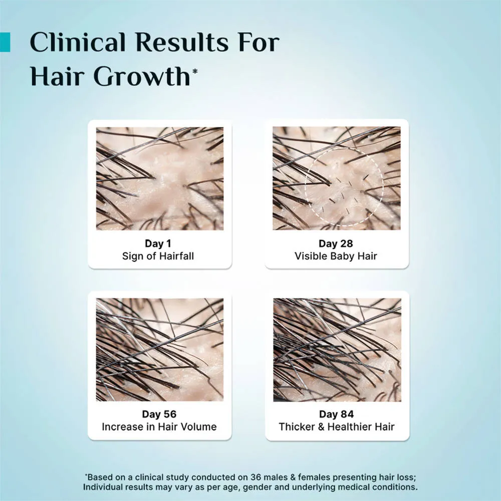Pilgrim 3% Redensyl 4% Anagain Rosemary Advance Hair Growth Serum For Men & Women- Pack of 2