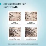 Pilgrim 3% Redensyl 4% Anagain Rosemary Advance Hair Growth Serum For Men & Women- Pack of 2 view 11