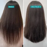 Pilgrim Redensyl & Anagain Hairfall Control Shampoo view 6