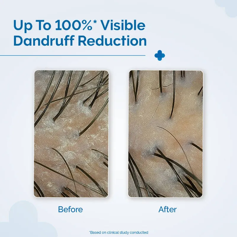 The Derma Co Triple Actives Anti-Dandruff Shampoo