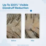 The Derma Co Triple Actives Anti-Dandruff Shampoo view 4