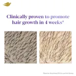 Dove Scalp + Hair Therapy Density Boost Revitalizing Scalp Night Serum view 2