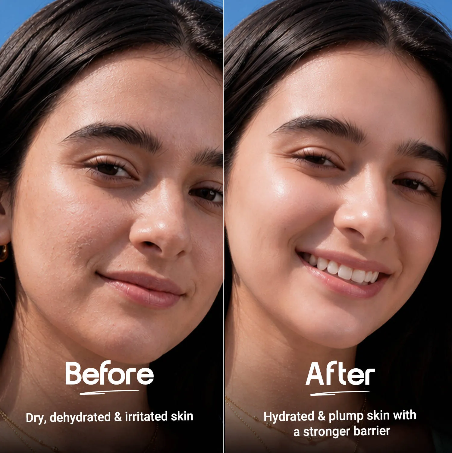 Aqualogica Barrier+ Hydra Gel Moisturizer With 5 Ceramides & Avocado For 24 Hour Intense Hydration