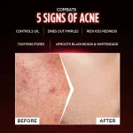Garnier Men AcnoFight Anti Pimple Face Wash view 7