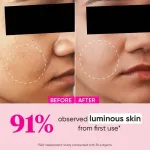 Dot & Key 10% Glycolic Watermelon Super Glow Face Serum For Pigmentation view 3