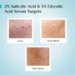 Pilgrim Salicylic & Glycolic Acid Anti Acne Serum view 5