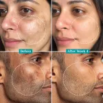 Pilgrim 15% Vitamin C Serum for Advance Brightening Fades Hyperpigmentation & Dark Spots Anti Aging view 16
