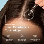 Pilgrim 3% Redensyl 4% Anagain Rosemary Advance Hair Growth Serum For Men & Women- Pack of 2 view 6