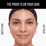 Dr. Sheth's Lipo-Gluta & Alpha Arbutin Pigmentation Serum view 6