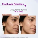 The Derma Co 10% Vitamin C Face Serum Reduces Pigmentation & Glowing Skin For All Skin Types view 7